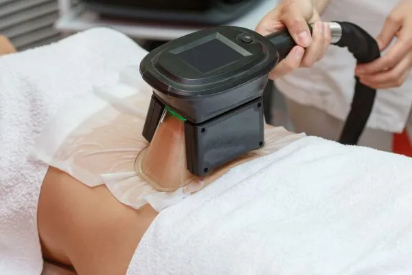 Image of person having fat freezing treatment to help weight gain Dagenham